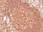  CD45 / LCA (Leucocyte Marker) Antibody - With BSA and Azide